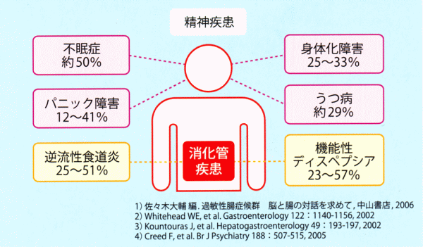 ibs とは 電源